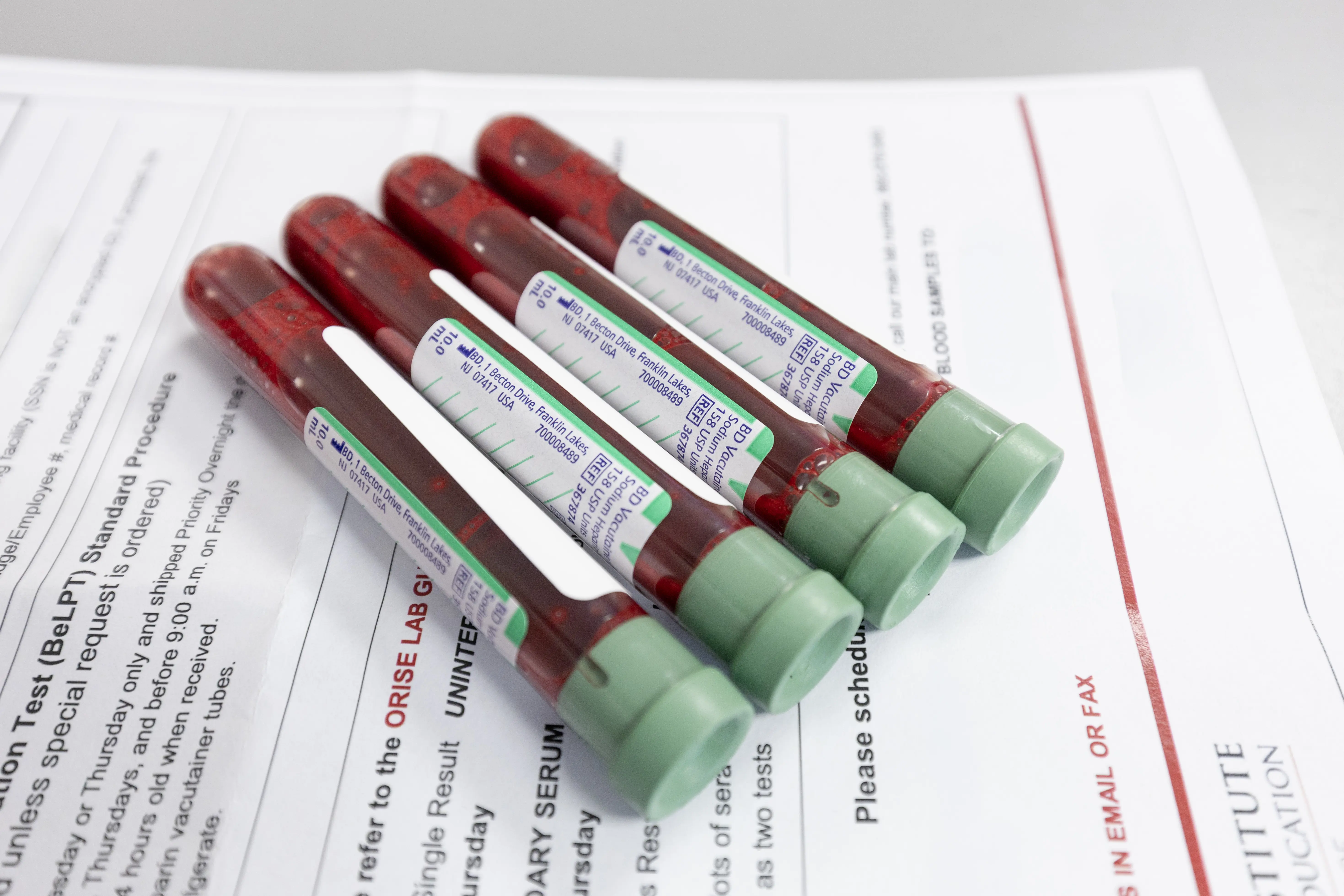 Blood samples